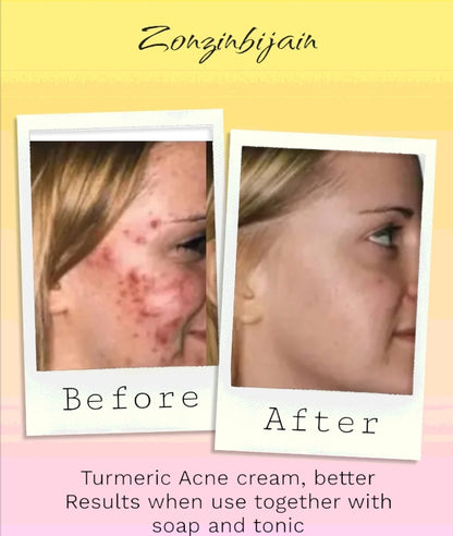 Turmeric moisturizer NO MORE WRINKLES!